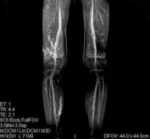 mr-angiografiya