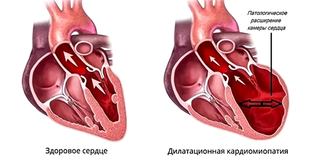 Селесил - самая лучшая, биодоступная форма селена